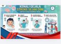 Kenali Gejala Stroke Sejak Dini untuk Cegah Dampak Fatal