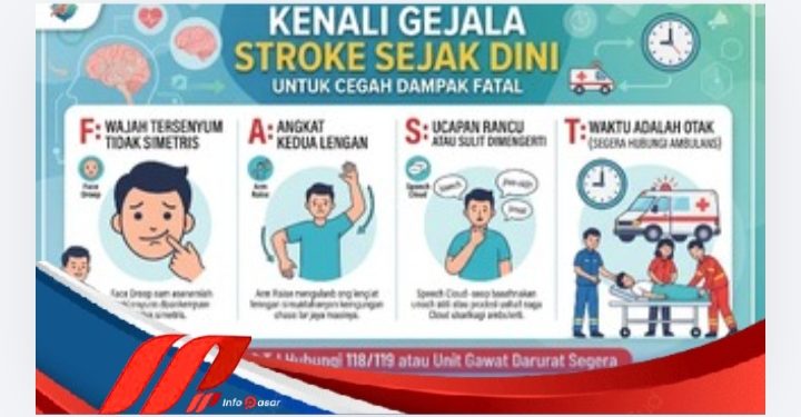 Kenali Gejala Stroke Sejak Dini untuk Cegah Dampak Fatal