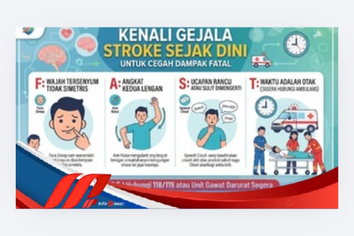 Kenali Gejala Stroke Sejak Dini untuk Cegah Dampak Fatal